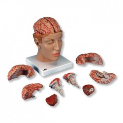 Πρόπλασμα Ανθρώπινου Εγκεφάλου C25